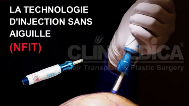 Σικελία: Εμβόλιο κατά του Covid με τη «σύριγγα χωρίς βελόνα»