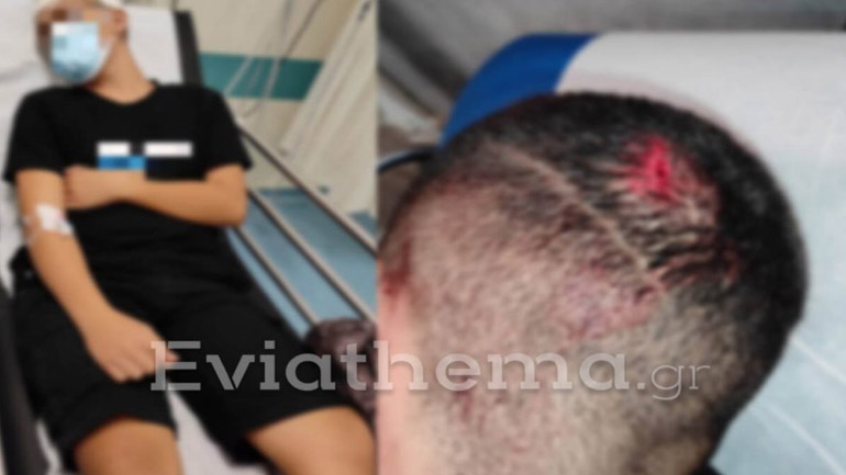 Αλιβέρι: 21χρονος τραυμάτισε σοβαρά στο κεφάλι 15χρονο