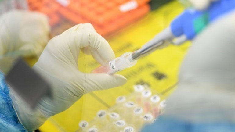 Βρετανία: Εγκρίθηκε το κοκτέιλ αντισωμάτων των Regeneron/Roche για τη θεραπεία του Covid-19