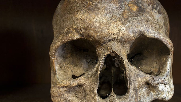 Θρίλερ με κρανίο που βρέθηκε μετά τη φωτιά στα Βίλια Θρίλερ με κρανίο που βρέθηκε μετά τη φωτιά στα Βίλια