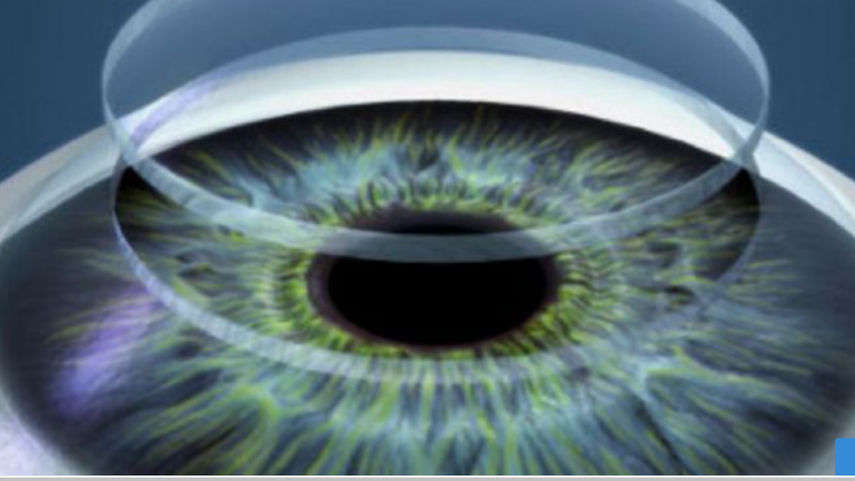 3D βιοεκτυπώσεις ανθρωπίνων ιστών & οργάνων