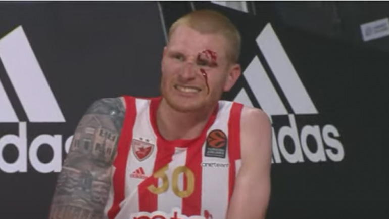 Σοκαριστικός τραυματισμός του Άαρον Γουάιτ στο φιλικό Ερυθρός Αστέρας-Παναθηναϊκός