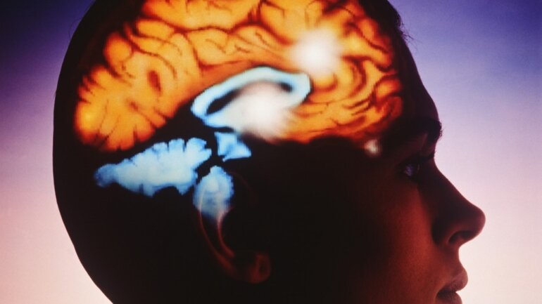 Η υπέρταση ίσως αρχίζει να επηρεάζει τον εγκέφαλο από τη μέση ηλικία