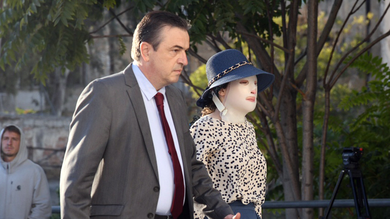 “Η θερμοκρασία των εγκαυμάτων της ήταν 400 βαθμοί Κελσίου”