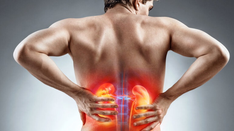 Συμπτώματα και αιτίες της υδρονέφρωσης σε παιδιά και ενήλικες