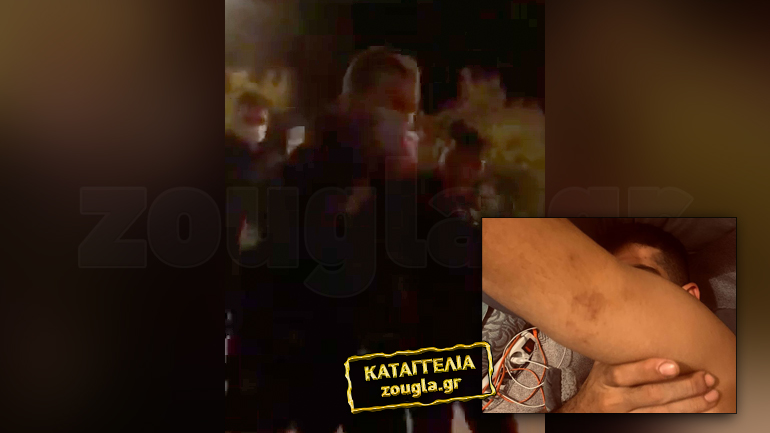 Καταγγελία: Περιστατικό αστυνομικής βίας σε έλεγχο στο Γαλάτσι – “Με χτυπούσαν στο περιπολικό 5 άτομα”