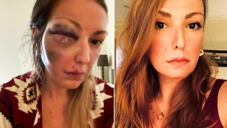 Θρίλερ με τον ξυλοδαρμό της food blogger στην Κρήτη