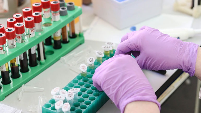 Συχνές ερωτήσεις για την τανταλαφίλη