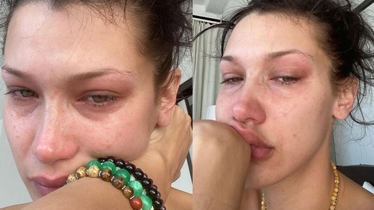 Η Bella Hadid με δάκρυα στα μάτια μιλά για την ψυχική υγεία: «Αυτή είναι η ζωή μου κάθε μέρα…»