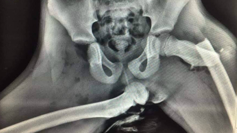 Γιατί δεν πρέπει ποτέ να βάζουμε τα πόδια στο ταμπλό του αυτοκινήτου;