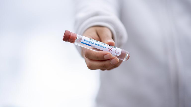 H μετάλλαξη «Όμικρον» γεννήθηκε πιθανότατα σε ασθενή με AIDS