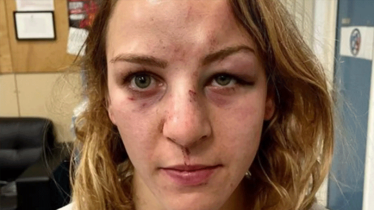 Τζούντο: Η Γαλλίδα Ολυμπιονίκης Μαργκό Πινό καταγγέλλει κακοποίησή της από τον σύντροφο και προπονητή της