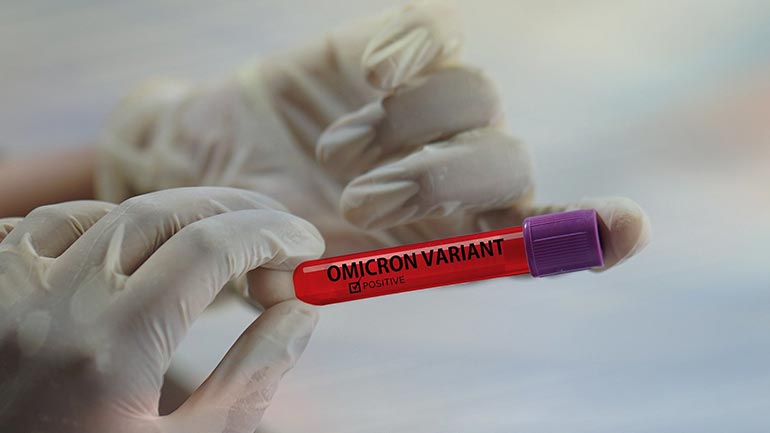 Η ΠΑΡΑΛΛΑΓΗ ΟΜΙΚΡΟΝ και Η ΑΝΘΕΚΤΙΚΟΤΗΤΑ ΤΗΣ ΣΤΑ «ΕΜΒΟΛΙΑ» – Επιμέλεια Κλεάνθης Γρίβας