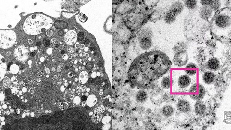 Ιδού η παραλλαγή «Όμικρον»