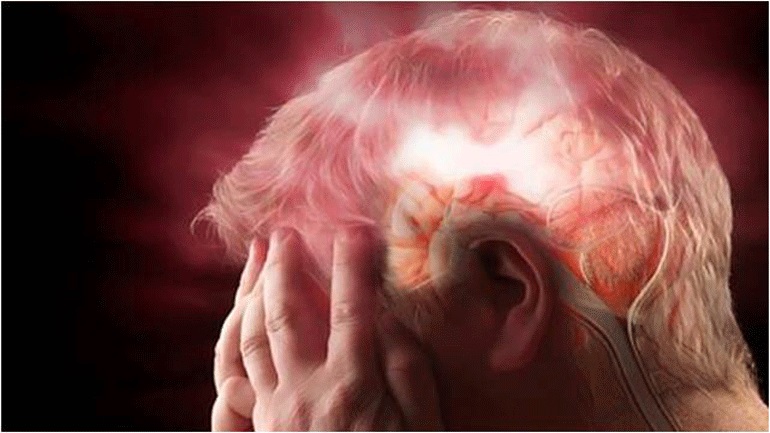 Μειώνονται διαχρονικά τα εγκεφαλικά παγκοσμίως και η θνησιμότητά τους, αλλά παραμένουν ακόμη σε υψηλά επίπεδα