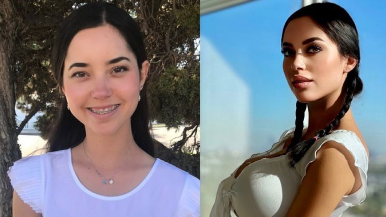 Γυναίκα ξόδεψε 50.000 δολάρια σε πλαστικές – Δείτε το αποτέλεσμα