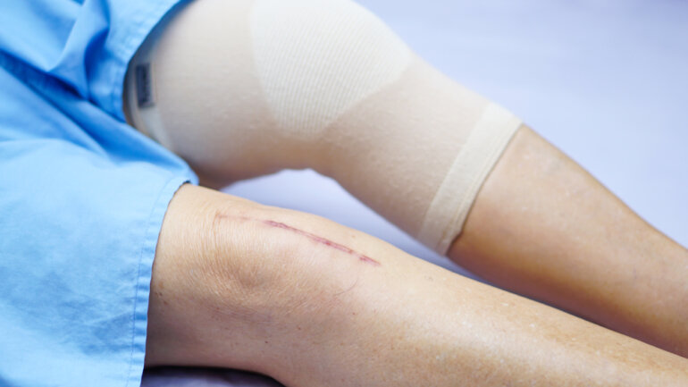 Αρθροπλαστική: Nεότερα δεδομένα και οφέλη για τον ασθενή