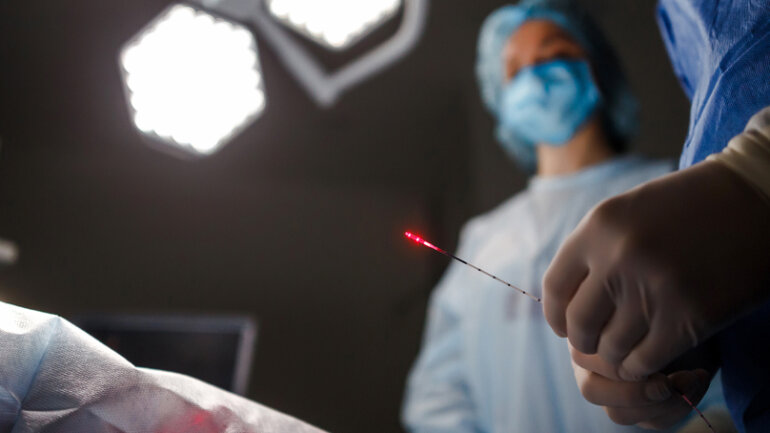 Ενδοαυλικό Laser: Νέο όπλο κατά της φλεβικής ανεπάρκειας και των κιρσών