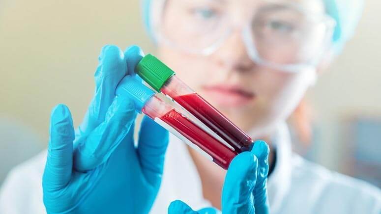 Μελέτη επιβεβαιώνει τον ρόλο των θρεπτικών συστατικών στον παιδικό καρκίνο του αίματος