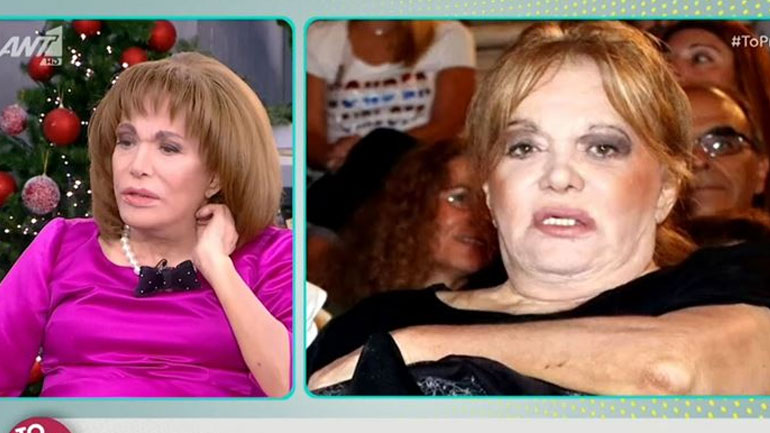 Μαίρη Χρονοπούλου: Πώς έχασε 56 κιλά μέσα σε δύο χρόνια