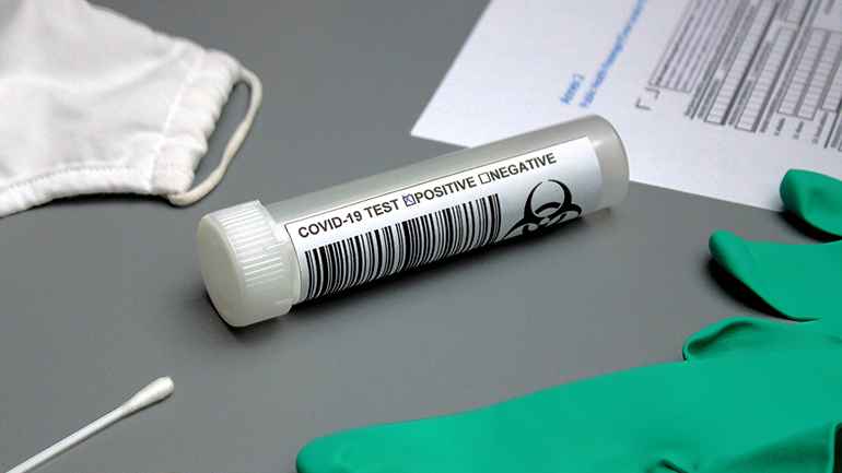 Ισραήλ: Πάνω από 5.400 περιστατικά κορωνοϊού – Ο υψηλότερος αριθμός από τον Σεπτέμβριο Ισραήλ: Πάνω από 5.400 περιστατικά κορωνοϊού – Ο υψηλότερος αριθμός από τον Σεπτέμβριο