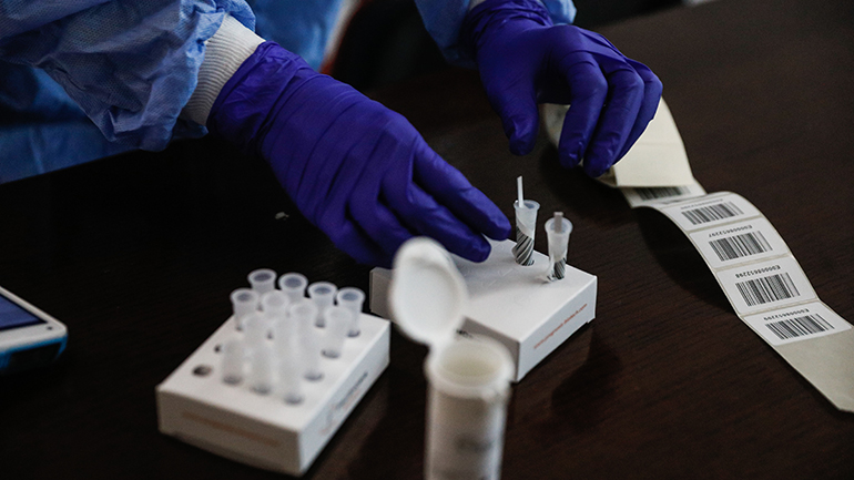 Αυτά είναι τα rapid tests και self tests που έχουν λάβει πιστοποιητικό από τον ΕΟΦ