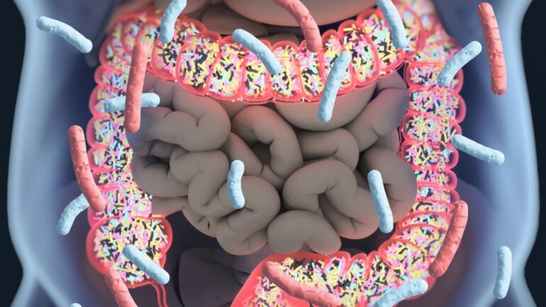 Η διατροφή με υψηλή περιεκτικότητα σε ζάχαρη μπορεί να βλάψει το έντερο