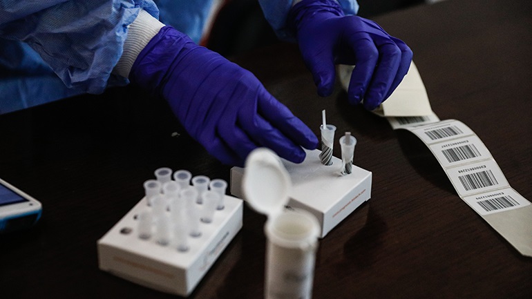 Υπ. Εργασίας: Αρκεί το θετικό rapid test για να απουσιάσει κάποιος από την εργασία του