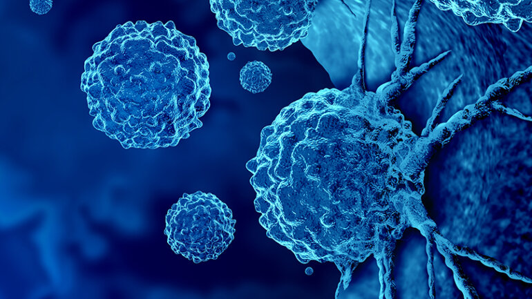 Νέες, εντυπωσιακές θεραπείες κατά του καρκίνου
