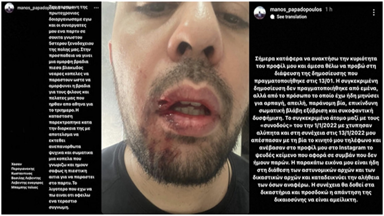 Η επόμενη δικαιολογία για τον βιασμό τής 24χρονης στη Θεσσαλονίκη: «Δεν είμαι βιαστής. Μού χάκαραν το πέος.»