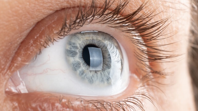 Κάτι στα μάτια σας μπορεί να αποκαλύψει εάν κινδυνεύετε από πρόωρο θάνατο