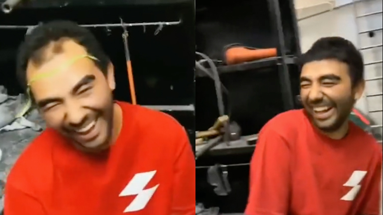 Πώς θα κάνεις μόνος σου εμφύτευση μαλλιών