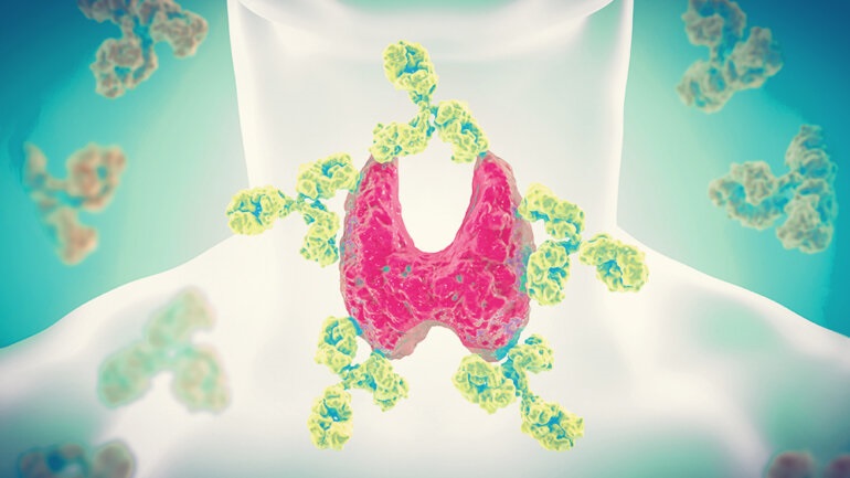 Ασθενείς με Hashimoto έχουν απόκριση στο εμβόλιο όπως τα υγιή άτομα, αλλά μπορεί να επηρεάζεται η θυρεοειδική λειτουργία