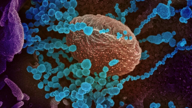 Περισσότεροι από 1,2 εκατ. άνθρωποι χάνουν τη ζωή τους παγκοσμίως από βακτηριακές λοιμώξεις