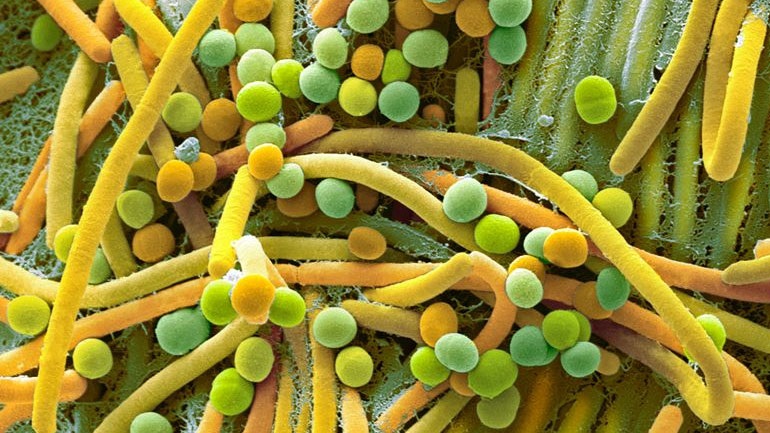 Νέα στοιχεία για το πώς τα μικρόβια του εντέρου μπορούν να προκαλέσουν παχυσαρκία