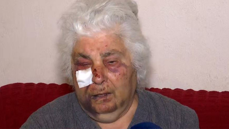 Ασπρόπυργος: Ληστές ξυλοκόπησαν άγρια ηλικιωμένη μέσα στο σπίτι της