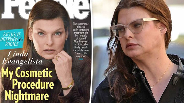 Linda Evangelista για την παραμόρφωση που υπέστη μετά από επέμβαση: «Έχω σταματήσει να κοιτάω τον καθρέφτη»