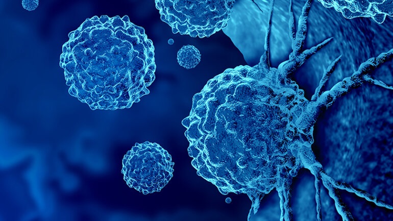 COVID-19: Γηριατρικοί παράγοντες κινδύνου για δυσμενή αποτελέσματα σε ηλικιωμένους ασθενείς με  και καρκίνο