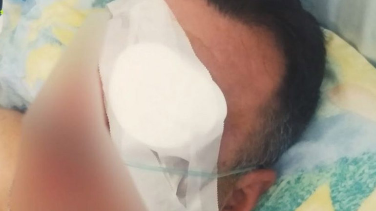 Χανιά: «Μου ξερίζωσε το μάτι με το δάχτυλό του για ένα κέρασμα»