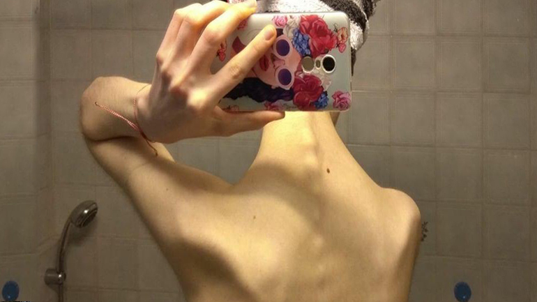 Όταν το φαγητό από σύμμαχος γίνεται εχθρός