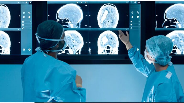 Έρευνα δείχνει τι συμβαίνει στον εγκέφαλό μας όταν αλλάζουμε γνώμη