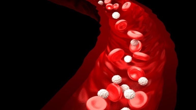 Η επίδραση της νόσου COVID-19 στα αγγεία είναι ανάλογη της βαρύτητας της νόσου