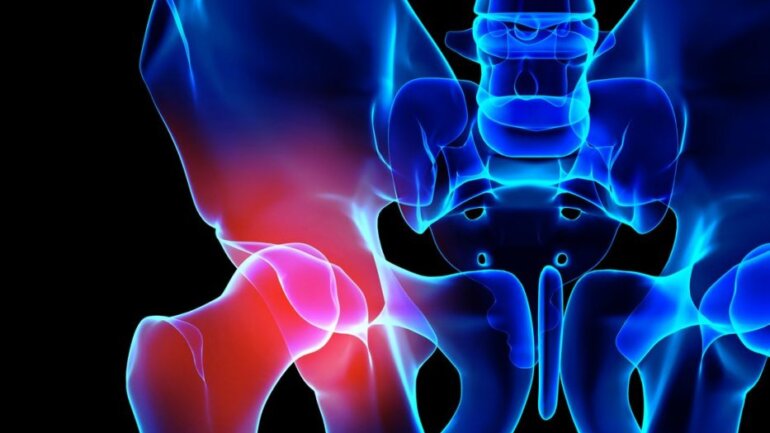 Αντιμετώπιση καταγμάτων ισχίου ηλικιωμένων με ελάχιστη επεμβατικότητα Αντιμετώπιση καταγμάτων ισχίου ηλικιωμένων με ελάχιστη επεμβατικότητα