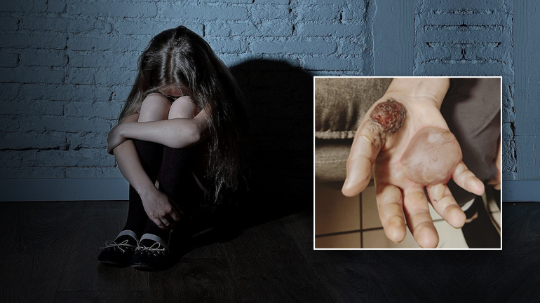 Βασάνιζε και κακοποιούσε σεξουαλικά τη 14χρονη κόρη του