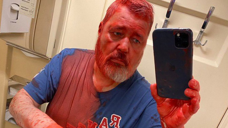 Ρωσία: Επίθεση με κόκκινη μπογιά κατά του διευθυντή της Novaya Gazeta