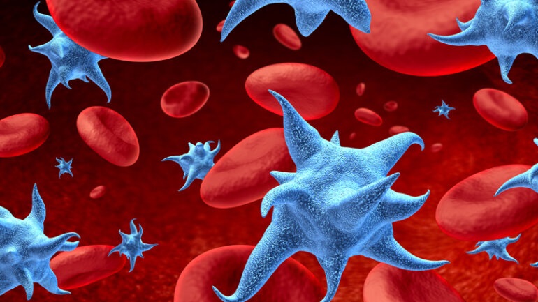 COVID-19: Aκόμη και άτομα με ήπια νόσηση παρουσιάζουν αυξημένο κίνδυνο για εν τω βάθει φλεβοθρόμβωση