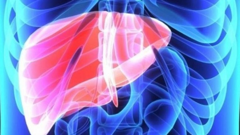 Σχεδόν τρία χρόνια λιγότερο ζουν τα άτομα που έχουν μη αλκοολική λιπώδη ηπατική νόσο