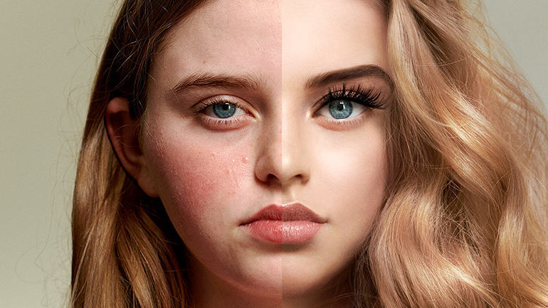 Selfie Self Esteem: Οι πιέσεις στα μέσα κοινωνικής δικτύωσης οδηγούν τα κορίτσια παγκοσμίως στο να διαστρεβλώνουν την εμφάνιση τους στο διαδίκτυο