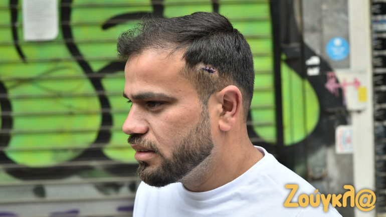 Ρατσιστική επίθεση στα Πατήσια: «Κάθε φορά που έρχεται η δίκη της Χρυσής Αυγής ενεργοποιούνται φασιστικοί πυρήνες»