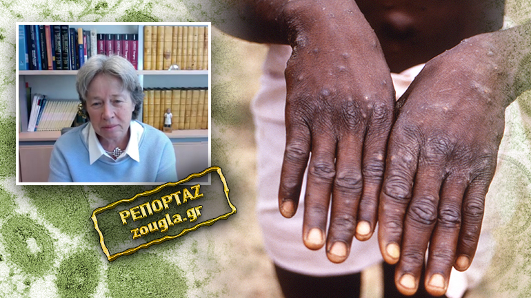 Λινού: «Με ανησυχεί η εξάπλωση της ευλογιάς των πιθήκων»